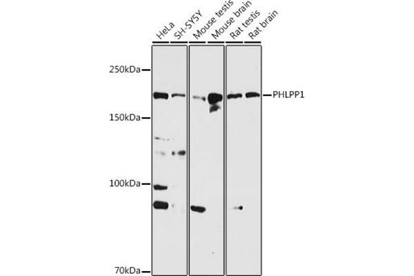 PHLPP1 Antikörper  (AA 1508-1717)