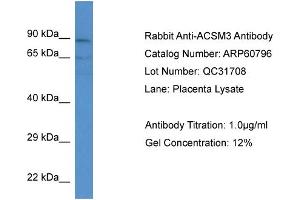 Western Blotting (WB) image for anti-Acyl-CoA Synthetase Medium-Chain Family Member 3 (ACSM3) (N-Term) antibody (ABIN786277) (ACSM3 anticorps  (N-Term))