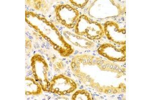 Immunohistochemistry of paraffin-embedded Human kidney using OLR1 antibody at dilution of 1:100 (x400 lens). (OLR1 anticorps  (AA 58-273))