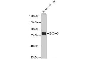 Western blot analysis of extracts of Mouse kidney using ZCCHC4 Polyclonal Antibody at dilution of 1:1000. (ZCCHC4 anticorps)