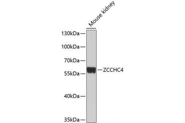 ZCCHC4 anticorps