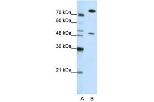 WB Suggested Anti-SSB Antibody Titration: 0. (SSB anticorps  (N-Term))