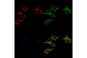 ABIN6258440 and ABIN6275234 staining 3 by IF/ICC. (MRPS22 anticorps  (C-Term))