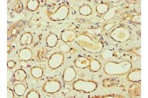 Immunohistochemistry of paraffin-embedded human kidney tissue using ABIN7145241 at dilution of 1:100 (BBS4 anticorps  (AA 350-519))