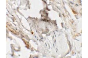 Immunohistochemistry of HHATL in human skin tissue with HHATL antibody at 2.