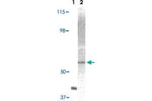 Western blot analysis using AKT2 monoclonal antibody, clone 1G8C12  against truncated AKT2 recombinant protein (Lane 1) and A-431 cell lysate (Lane 2). (AKT2 anticorps)
