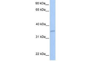 NKIRAS2 antibody used at 1 ug/ml to detect target protein. (NKIRAS2 anticorps  (Middle Region))