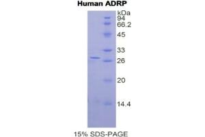 SDS-PAGE analysis of Human ADRP Protein. (ADRP Protéine)