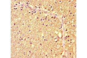 Immunohistochemistry of paraffin-embedded human brain tissue using ABIN7175986 at dilution of 1:100