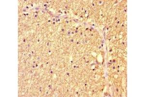 Immunohistochemistry of paraffin-embedded human brain tissue using ABIN7175986 at dilution of 1:100 (ZBTB46 anticorps  (AA 174-362))