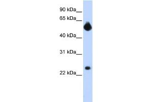 WB Suggested Anti-NOTCH4 Antibody Titration:  0. (NOTCH4 anticorps  (Middle Region))