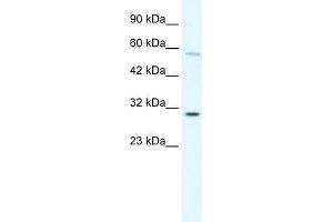 Human K562; WB Suggested Anti-GATAD1 Antibody Titration: 0. (GATAD1 anticorps  (C-Term))