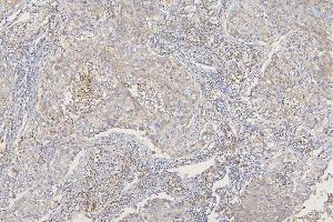 IHC analysis of SFRP1 using anti-SFRP1 antibody (ABIN6719484). (SFRP1 anticorps)