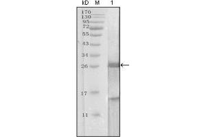 Western Blotting (WB) image for anti-Prostate Specific Antigen (PSA) (AA 26-251) antibody (ABIN2983296) (Prostate Specific Antigen anticorps  (AA 26-251))