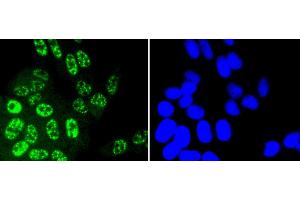 Immunofluorescence analysis of HeLa cells using Phospho-JNK1/2/3-T183/T183/T221 antibody (abx125450).