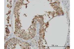 Immunoperoxidase of monoclonal antibody to HSPA1L on formalin-fixed paraffin-embedded human testis.