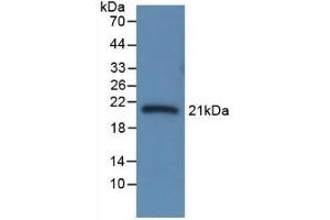 Detection of Recombinant CBG, Rat using Monoclonal Antibody to Corticosteroid Binding Globulin (CBG)