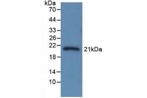 Detection of Recombinant CBG, Rat using Monoclonal Antibody to Corticosteroid Binding Globulin (CBG) (SERPINA6 anticorps  (AA 173-344))
