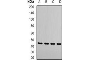 Western blot analysis of RRM2 expression in MCF7 (A), Hela (B), Jurakt (C), mouse thymus (D) whole cell lysates.