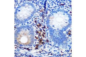 Immunohistochemistry of paraffin-embedded human appendix using CD41/ITGB Rabbit mAb (ABIN7267925) at dilution of 1:100 (40x lens).