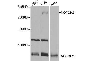 Western blot analysis of extracts of various cell lines, using NOTCH2 antibody. (NOTCH2 anticorps)