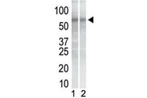 Western blot testing of mouse NIH3T3 cell lysate (Lane 1) and human K562 cell lysate (2) with CHK1 antibody. (CHEK1 anticorps)