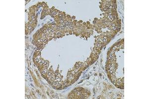 Immunohistochemistry of paraffin-embedded human prostate using CHRFA antibody (ABIN6131933, ABIN6138559, ABIN6138561 and ABIN6223818) at dilution of 1:100 (40x lens). (CHRFAM7A anticorps  (AA 1-150))