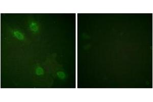 Immunofluorescence (IF) image for anti-Mediator Complex Subunit 1 (MED1) (AA 1423-1472) antibody (ABIN2888695) (MED1 anticorps  (AA 1423-1472))