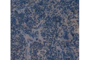 IHC-P analysis of Rat Tissue, with DAB staining. (Cathelicidin anticorps  (AA 30-175))
