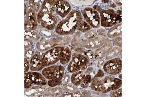 Immunohistochemical staining of human kidney with C20orf196 polyclonal antibody  shows strong cytoplasmic positivity in tubular cells at 1:50-1:200 dilution. (C20ORF196 anticorps)
