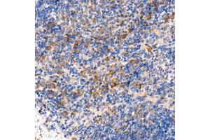 Immunohistochemistry of paraffin-embedded mouse spleen using [KO Validated] MyD88 Rabbit mAb (ABIN7268723) at dilution of 1:1000 (40x lens).
