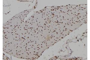 ABIN6276949 at 1/100 staining Human gastric tissue by IHC-P. (HOXA9 anticorps  (Internal Region))