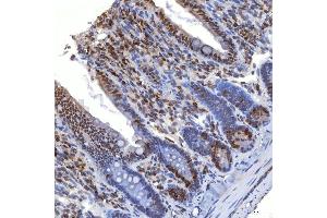 IHC analysis of TRMT61A using anti-TRMT61A antibody (ABIN7599220). (TRMT61A anticorps  (AA 1-289))