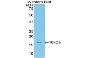 Western Blotting (WB) image for anti-Galectin 7 (LGALS7) (AA 1-128) antibody (ABIN1172746) (LGALS7 anticorps  (AA 1-128))