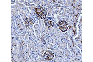 IHC analysis of CD147/Emmprin using anti-CD147/Emmprin antibody (ABIN7599999). (CD147 anticorps  (AA 138-323))