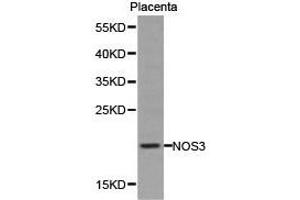 Western Blotting (WB) image for anti-Nitric Oxide Synthase 3 (Endothelial Cell) (NOS3) antibody (ABIN1873922) (ENOS anticorps)