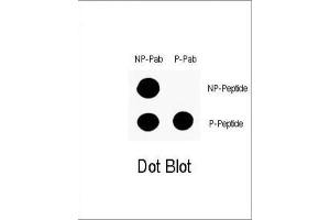 Dot Blot (DB) image for anti-Tumor Protein P53 (TP53) (pSer9) antibody (ABIN3001774)
