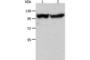 Western Blot analysis of Human fetal muscle tissue and hela cell using ACTN3 Polyclonal Antibody at dilution of 1:400 (ACTN3 anticorps)