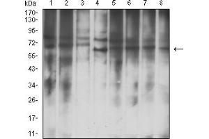 Western blot analysis using IGF2BP3 mouse mAb against Hela (1), Jurkat (2), NIH/3T3 (3), COS7 (4), HepG2 (5), K562 (6), A549 (7), and HEK293 (8) cell lysate.