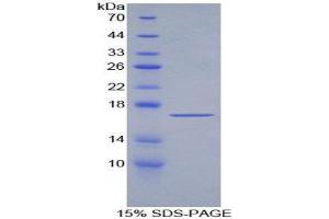 SDS-PAGE (SDS) image for Transforming Growth Factor, beta 2 (TGFB2) (AA 303-414) protein (His tag) (ABIN1880027) (TGFB2 Protein (AA 303-414) (His tag))