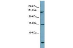 Image no. 1 for anti-LATS, Large Tumor Suppressor, Homolog 1 (Drosophila) (LATS1) (AA 971-1020) antibody (ABIN6741908) (LATS1 anticorps  (AA 971-1020))