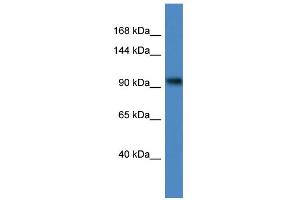 WB Suggested Anti-ZBTB4 Antibody Titration:  0. (ZBTB4 anticorps  (C-Term))