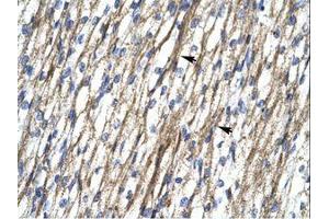 Image no. 1 for anti-RNA Binding Motif Protein 10 (RBM10) (AA 79-128) antibody (ABIN202953)