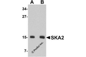 Western Blotting (WB) image for anti-Spindle and Kinetochore-Associated Protein 2 (FAM33A) (N-Term) antibody (ABIN1031572) (FAM33A anticorps  (N-Term))