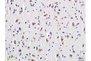 Formalin-fixed and paraffin embedded rat brain tissue labeled with Anti-CD137/TNFRSF9 Polyclonal Antibody, Unconjugated (ABIN740445) at 1:600 followed by conjugation to the secondary antibody (CD137 anticorps  (AA 101-200))