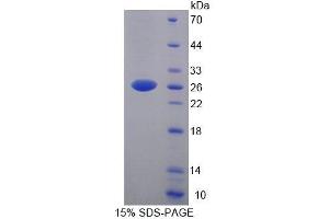 SDS-PAGE analysis of Human YAF2 Protein. (YAF2 Protéine)