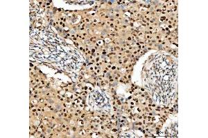 IHC analysis of PCNA using anti-PCNA antibody (ABIN7599179).