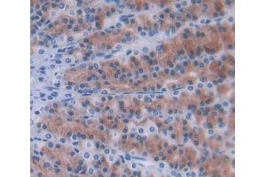 Used in DAB staining on fromalin fixed paraffin- embedded Kidney tissue (Ninein anticorps  (AA 1-153))