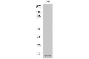 Western Blotting (WB) image for anti-Cystatin B (Stefin B) (CSTB) (Internal Region) antibody (ABIN3174683) (CSTB anticorps  (Internal Region))