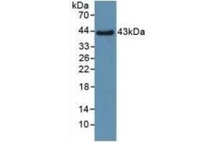 Detection of Recombinant SPD, Human using Polyclonal Antibody to Surfactant Associated Protein D (SPD)